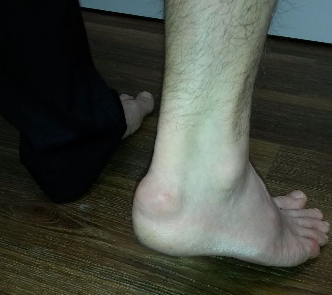 Bilder gichtzentrummuenchen.de